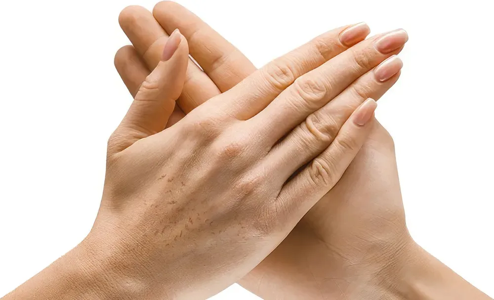 До